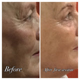High Performance Facial