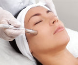 Dermabrasion